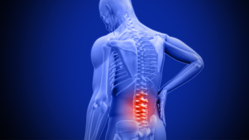 What Is Lumbar Spinal Stenosis? Causes, Symptoms & Early Warning Signs